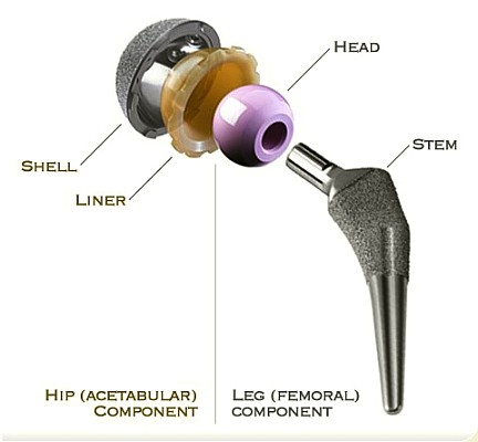 artificial hip components