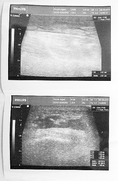 the ultrasound pictures