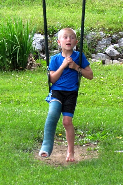 Ty with his long leg cast